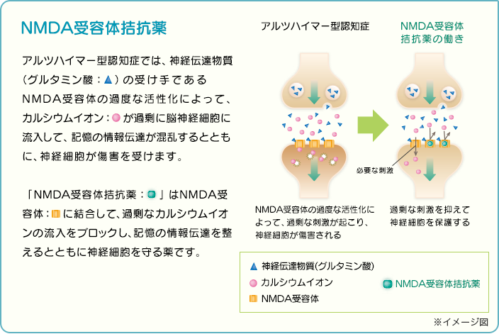 NMDA受容体拮抗薬 アルツハイマー型認知症では、神経伝達物質 （グルタミン酸）の受け手であるNMDA受容体の過度な活性化によって、カルシウムイオンが過剰に脳神経細胞に流入して、記憶の情報伝達が混乱するとともに、神経細胞が傷害を受けます。「NMDA受容体拮抗薬」はNMDA受容体に結合して、過剰なカルシウムイオンの流入をブロックし、記憶の情報伝達を整えるとともに神経細胞を守る薬です。 アルツハイマー型認知症 NMDA受容体の過度な活性化によって、過剰な刺激が起こり、神経細胞が傷害される NMDA受容体拮抗薬の働き 過剰な刺激を抑えて神経細胞を保護する