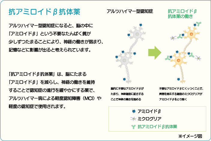 抗アミロイドβ抗体薬 アルツハイマー型認知症になると、脳の中に「アミロイドβ」という不要なたんぱく質が少しずつたまることにより、神経の働きが弱まり、記憶などに影響が出ると考えられています。「抗アミロイドβ抗体薬」は、脳にたまる「アミロイドβ」を減らし、神経の働きを維持することで認知症の進行を緩やかにする薬で、アルツハイマー病による軽度認知障害（MCI）や軽度の認知症で使用されます。 アルツハイマー型認知症 脳内に不要なアミロイドβがたまり、神経細胞に結合することで神経の働きを弱める → 抗アミロイドβ抗体薬の働き 不要なアミロイドβにくっつくことで、異物を除去する細胞のミクログリアがアミロイドβをとり除く ※イメージ図